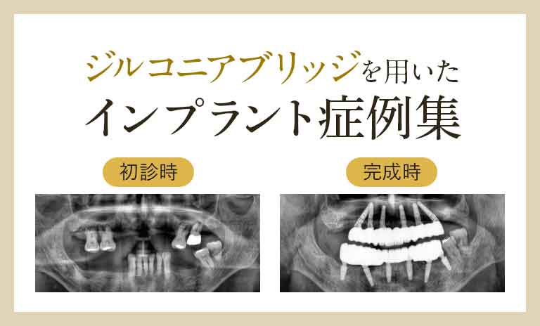 筋機能療法