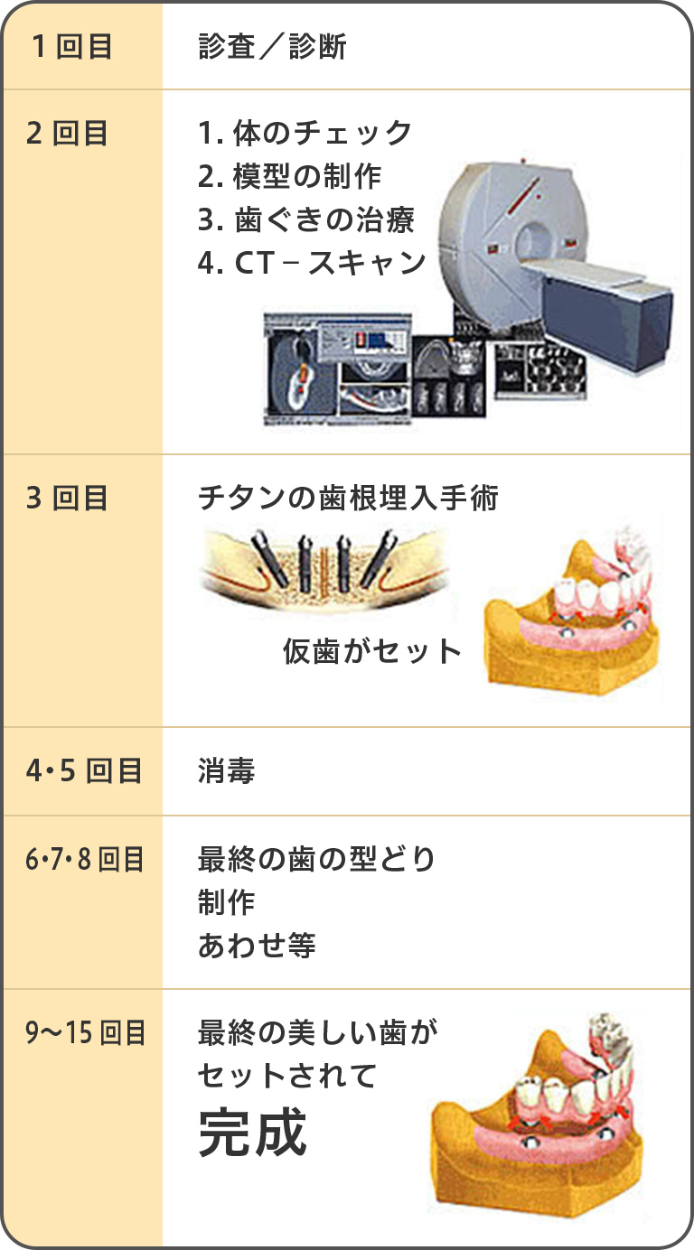 京都で最大級の実績のall On 4 オールオンフォーについて 五十嵐歯科医院