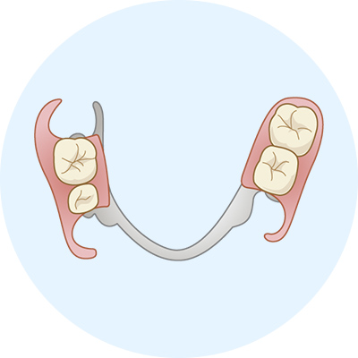 部分入れ歯