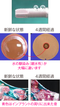 光機能化すると、血液や歯肉となじみやすい