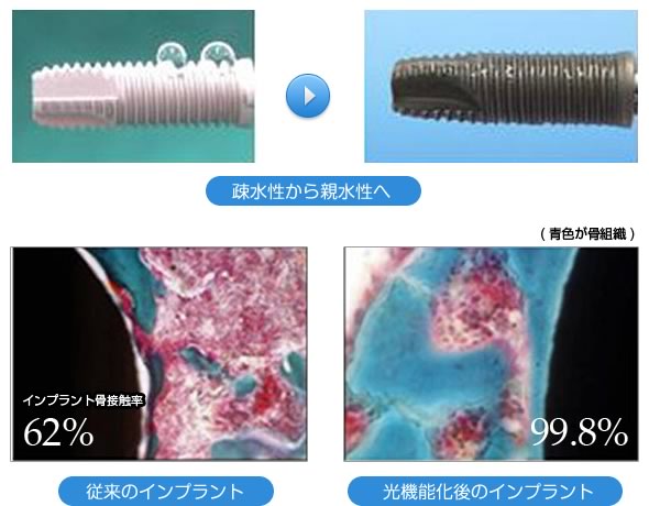 光を当てる前と後でのインプラント表面の変化