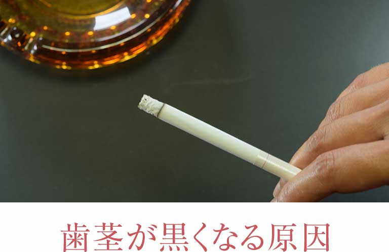 インプラント治療をすると
歯茎は黒くなる?
