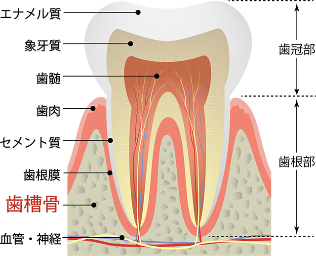 インプラントを埋め込むためには十分な歯槽骨が必要