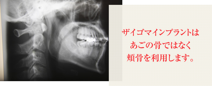黄ばみ・黒ずみや歯ぐきとの間の黒い線に