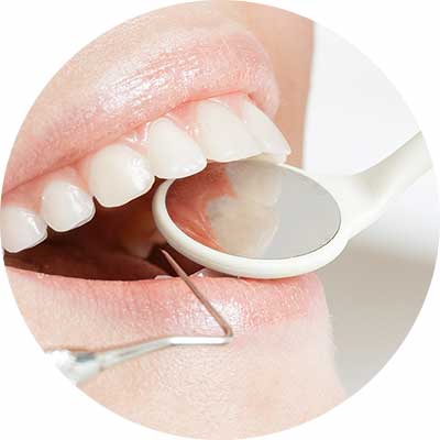 進行してしまった場歯周病は定期的なメンテナンスが大事合には外科治療を行うケースも