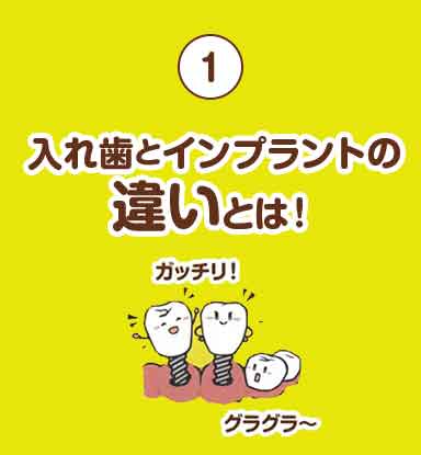 入れ歯とインプラントの違い