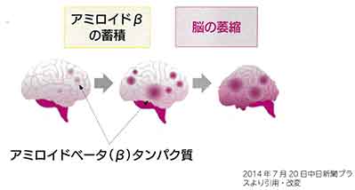 解説図