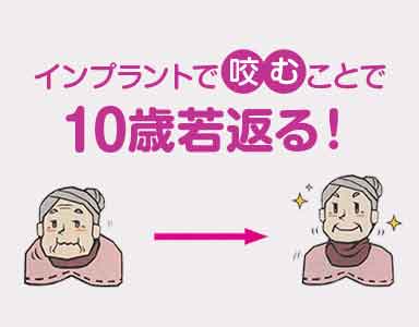 インプラントで咬むことで10歳若返る