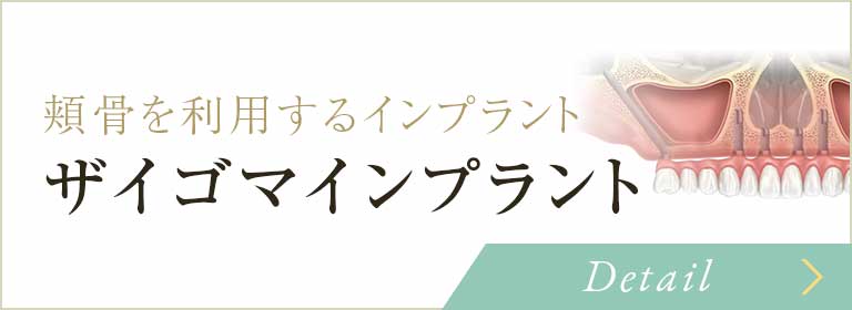 ザイゴマインプラント