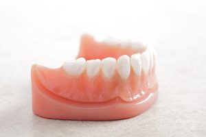 allon4_overdenture_02